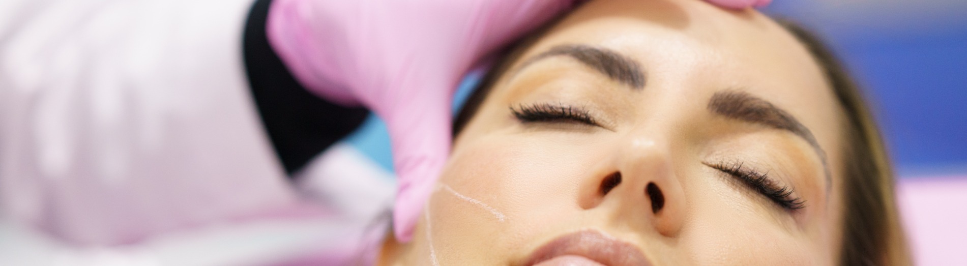 Dew Aesthetics, Chester | Threadlifts, Microdermabrasion, Skincare | Woman having thread lifts